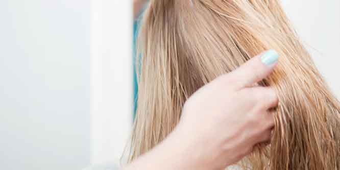 Alopecia areata och hirsutism
