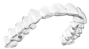 Aligners flyttar tänderna stegvis med en serie genomskinliga skenor.